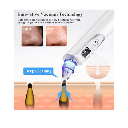 GOODSKY Blackhead Remover Vacuum, Electric Comedo Suction Removal Tool