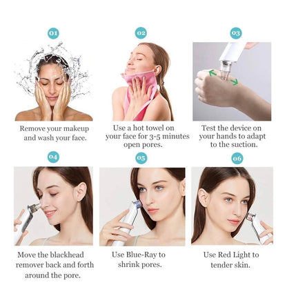 GOODSKY Blackhead Remover Vacuum, Electric Comedo Suction Removal Tool