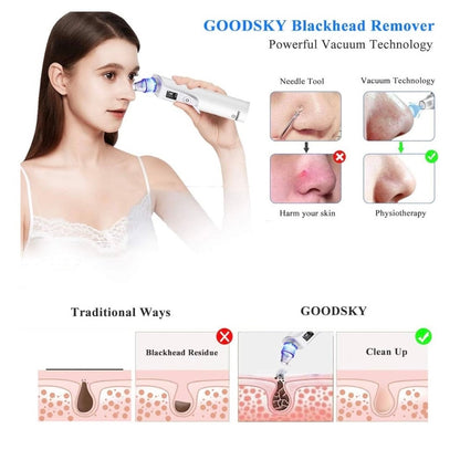 GOODSKY Blackhead Remover Vacuum, Electric Comedo Suction Removal Tool